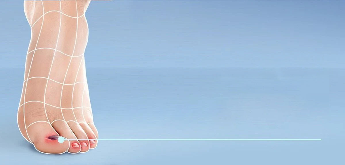 Black toenail-Scholl UK